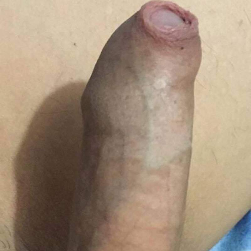 Aklave